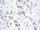 HOXA1 Antibody - HOXA1 antibody ARP34773_T100-NP_705873-HOXA1 (homeobox A1) Antibody was used in IHC to stain formalin-fixed, paraffin-embedded human brain.  This image was taken for the unconjugated form of this product. Other forms have not been tested.