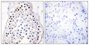 HOXA1/HOXB1/HOXD1 Antibody - Immunohistochemistry analysis of paraffin-embedded human testis tissue, using HOXA1/B1/D1 Antibody. The picture on the right is blocked with the synthesized peptide.