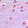 Antibody - Immunohistochemical analysis of HOXA11/D11 staining in human brain formalin fixed paraffin embedded tissue section. The section was pre-treated using heat mediated antigen retrieval with sodium citrate buffer (pH 6.0). The section was then incubated with the antibody at room temperature and detected using an HRP conjugated compact polymer system. DAB was used as the chromogen. The section was then counterstained with hematoxylin and mounted with DPX.