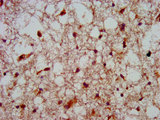 HOXA4 Antibody - Immunohistochemistry image at a dilution of 1:800 and staining in paraffin-embedded human brain tissue performed on a Leica BondTM system. After dewaxing and hydration, antigen retrieval was mediated by high pressure in a citrate buffer (pH 6.0) . Section was blocked with 10% normal goat serum 30min at RT. Then primary antibody (1% BSA) was incubated at 4 °C overnight. The primary is detected by a biotinylated secondary antibody and visualized using an HRP conjugated SP system.