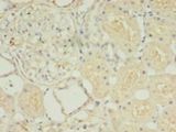 HOXA6 Antibody - Immunohistochemistry of paraffin-embedded human kidney tissue using antibody at 1:100 dilution.  This image was taken for the unconjugated form of this product. Other forms have not been tested.