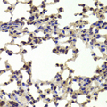 HOXB1 Antibody - Immunohistochemistry of paraffin-embedded Mouse lung tissue.
