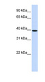 HOXB3 Antibody - antibody Western blot of Fetal Liver lysate. This image was taken for the unconjugated form of this product. Other forms have not been tested.