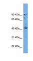 HOXB3 Antibody - HOXB3 antibody Western blot of NCI-H226 cell lysate. This image was taken for the unconjugated form of this product. Other forms have not been tested.
