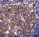 HOXB6 Antibody - HOXB6 Antibody immunohistochemistry of formalin-fixed and paraffin-embedded human tonsil tissue followed by peroxidase-conjugated secondary antibody and DAB staining.