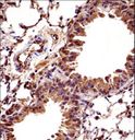HOXC10 Antibody - Mouse Hoxc10 Antibody immunohistochemistry of formalin-fixed and paraffin-embedded mouse lung tissue followed by peroxidase-conjugated secondary antibody and DAB staining.