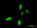 HOXC10 Antibody - Immunofluorescence of monoclonal antibody to HOXC10 on HeLa cell . [antibody concentration 10 ug/ml]
