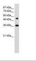 HOXC11 Antibody - Transfected 293T Cell Lysate.  This image was taken for the unconjugated form of this product. Other forms have not been tested.