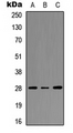 HOXC8 Antibody - Western blot analysis of HOXC8 expression in HEK293T (A); Raw264.7 (B); PC12 (C) whole cell lysates.