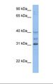 HOXD1 Antibody - MCF7 cell lysate. Antibody concentration: 1.0 ug/ml. Gel concentration: 12%.  This image was taken for the unconjugated form of this product. Other forms have not been tested.