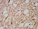 HOXD1 Antibody - Immunohistochemistry image at a dilution of 1:600 and staining in paraffin-embedded human brain tissue performed on a Leica BondTM system. After dewaxing and hydration, antigen retrieval was mediated by high pressure in a citrate buffer (pH 6.0) . Section was blocked with 10% normal goat serum 30min at RT. Then primary antibody (1% BSA) was incubated at 4 °C overnight. The primary is detected by a biotinylated secondary antibody and visualized using an HRP conjugated SP system.