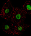 HOXD8 Antibody - Fluorescent image of HUVEC cell stained with HOXD8 Antibody. HUVEC cells were fixed with 4% PFA (20 min), permeabilized with Triton X-100 (0.1%, 10 min), then incubated with HOXD8 primary antibody (1:25, 1 h at 37°C). For secondary antibody, Alexa Fluor 488 conjugated donkey anti-rabbit antibody (green) was used (1:400, 50 min at 37°C). Cytoplasmic actin was counterstained with Alexa Fluor 555 (red) conjugated Phalloidin (7units/ml, 1 h at 37°C). HOXD8 immunoreactivity is localized to Nucleus significantly.