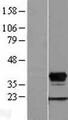 HOXD8 Protein - Western validation with an anti-DDK antibody * L: Control HEK293 lysate R: Over-expression lysate