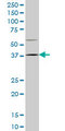 HOXD9 Antibody - HOXD9 monoclonal antibody (M01), clone 2A9 Western Blot analysis of HOXD9 expression in NIH/3T3.