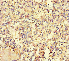 HOXD9 Antibody - Immunohistochemistry of paraffin-embedded human spleen tissue at dilution of 1:100