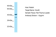 HOXD9 Antibody -  This image was taken for the unconjugated form of this product. Other forms have not been tested.