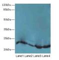 HPCAL4 Antibody - Western blot. All lanes: HPCAL4 antibody at 2 ug/ml. Lane 1: Mouse brain tissue. Lane 2: Mouse kidney tissue. Lane 3: Mouse ovarian tissue. Lane 4: Human placenta tissue. Secondary Goat polyclonal to Rabbit IgG at 1:10000 dilution. Predicted band size: 22 kDa. Observed band size: 22 kDa.