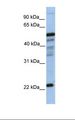 HPGDS Antibody - 721_B cell lysate. Antibody concentration: 1.0 ug/ml. Gel concentration: 12%.  This image was taken for the unconjugated form of this product. Other forms have not been tested.