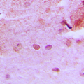 HPMS1 / PMS1 Antibody - Immunohistochemical analysis of PMS1 staining in human brain formalin fixed paraffin embedded tissue section. The section was pre-treated using heat mediated antigen retrieval with sodium citrate buffer (pH 6.0). The section was then incubated with the antibody at room temperature and detected using an HRP conjugated compact polymer system. DAB was used as the chromogen. The section was then counterstained with hematoxylin and mounted with DPX.