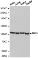 HPMS1 / PMS1 Antibody - Western blot of extracts of various cell lines, using PMS1 antibody.
