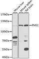 HPMS1 / PMS1 Antibody - Western blot analysis of extracts of various cell lines, using PMS1 antibody at 1:1000 dilution. The secondary antibody used was an HRP Goat Anti-Rabbit IgG (H+L) at 1:10000 dilution. Lysates were loaded 25ug per lane and 3% nonfat dry milk in TBST was used for blocking. An ECL Kit was used for detection and the exposure time was 5s.