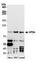 HPS4 Antibody - Detection of human HPS4 by western blot. Samples: Whole cell lysate (50 µg) from HeLa, HEK293T, and Jurkat cells prepared using NETN lysis buffer. Antibody: Affinity purified rabbit anti-HPS4 antibody used for WB at 0.4 µg/ml. Detection: Chemiluminescence with an exposure time of 3 minutes.