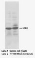 HPSE / Heparanase Antibody -  This image was taken for the unconjugated form of this product. Other forms have not been tested.