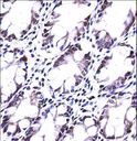 HRASLS5 Antibody - HRASLS5 Antibody immunohistochemistry of formalin-fixed and paraffin-embedded human rectum tissue followed by peroxidase-conjugated secondary antibody and DAB staining.