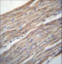 HRC / HCP Antibody - HRC Antibody immunohistochemistry of formalin-fixed and paraffin-embedded human heart tissue followed by peroxidase-conjugated secondary antibody and DAB staining.
