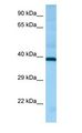 HRH2 / Histamine H2 Receptor Antibody - HRH2 / Histamine H2 Receptor antibody Western Blot of Fetal Brain.  This image was taken for the unconjugated form of this product. Other forms have not been tested.