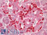 HS2ST1 Antibody - Human Pancreas, Islets of Langerhans: Formalin-Fixed, Paraffin-Embedded (FFPE)