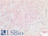 HS2ST1 Antibody - Human Smooth Muscle Negative Signal: Formalin-Fixed, Paraffin-Embedded (FFPE)