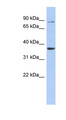 HS3ST1 Antibody - HS3ST1 antibody Western blot of Fetal Stomach lysate. This image was taken for the unconjugated form of this product. Other forms have not been tested.