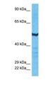 HS6ST2 Antibody - Western blot of H6ST2 Antibody with human MCF7 Whole Cell lysate.  This image was taken for the unconjugated form of this product. Other forms have not been tested.