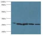 HSD17B10 / HADH2 Antibody - Western blot. All lanes: 3-hydroxyacyl-CoA dehydrogenase type-2 antibody at 2 ug/ml Lane 1:mouse brain tissue Lane 2: 293T whole cell lysate. Lane 3: HepG2 whole cell lysate Lane 4: HeLa whole cell lysate Lane 5: HT29 whole cell lysate. Secondary antibody: Goat polyclonal.  This image was taken for the unconjugated form of this product. Other forms have not been tested.