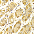 HSD17B2 Antibody - Immunohistochemistry of paraffin-embedded Human gastric tissue.