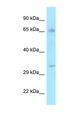 HSD17B3 Antibody - HSD17B3 antibody Western blot of 721_B Cell lysate. Antibody concentration 1 ug/ml.  This image was taken for the unconjugated form of this product. Other forms have not been tested.