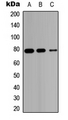 HSD17B4 Antibody - Western blot analysis of HSD17B4 expression in HEK293T (A); Raw264.7 (B); PC12 (C) whole cell lysates.