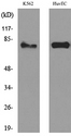 HSD17B4 Antibody - Western blot analysis of lysate from K562, HUVEC cells, using HSD17B4 Antibody.