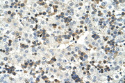 HSD17B6 Antibody - HSD17B6 antibody ARP41529_T100-NP_003716-HSD17B6(hydroxysteroid (17-beta) dehydrogenase 6 homolog (mouse)) Antibody IHC of formalin-fixed, paraffin-embedded human Liver. Positive label: Hematopoietic cells indicated with arrows. Antibody concentration 4-8 ug/ml. Magnification 400X.  This image was taken for the unconjugated form of this product. Other forms have not been tested.