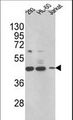 HSD17B7 / PRAP Antibody - Western blot of HSD17B7 Antibody in 293,HL-60,Jurkat cell line lysates (35 ug/lane). HSD17B7 (arrow) was detected using the purified antibody.(2 ug/ml)