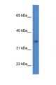 HSDL1 Antibody - HSDL1 antibody Western blot of HCT15 Cell lysate. Antibody concentration 1 ug/ml.  This image was taken for the unconjugated form of this product. Other forms have not been tested.