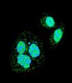 HSF1 Antibody - Confocal immunofluorescence of HSF1 Sumoylation Site Antibody with HeLa cell followed by Alexa Fluor 488-conjugated goat anti-rabbit lgG (green). DAPI was used to stain the cell nuclear (blue).