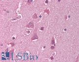 HSF1 Antibody - Anti-HSF1 antibody IHC of human brain, cortex. Immunohistochemistry of formalin-fixed, paraffin-embedded tissue after heat-induced antigen retrieval. Antibody concentration 5 ug/ml.  This image was taken for the unconjugated form of this product. Other forms have not been tested.