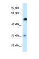 HSF2 Antibody - HSF2 antibody Western blot of 721_B Cell lysate. Antibody concentration 1 ug/ml.  This image was taken for the unconjugated form of this product. Other forms have not been tested.