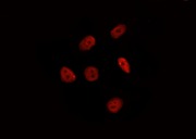 HSF2 Antibody - Staining HeLa cells by IF/ICC. The samples were fixed with PFA and permeabilized in 0.1% Triton X-100, then blocked in 10% serum for 45 min at 25°C. The primary antibody was diluted at 1:200 and incubated with the sample for 1 hour at 37°C. An Alexa Fluor 594 conjugated goat anti-rabbit IgG (H+L) Ab, diluted at 1/600, was used as the secondary antibody.