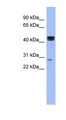 HSFY1 Antibody - HSFY1 antibody Western blot of COLO205 cell lysate. This image was taken for the unconjugated form of this product. Other forms have not been tested.