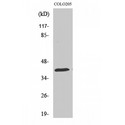 HSP40 Antibody - Western blot of HSP40 antibody