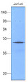 HSP40 Antibody - Cell lysates of Jurkat (50 ug) were resolved by SDS-PAGE, transferred to NC membrane and probed with anti-human Hsp40 (1:1000). Proteins were visualized using a goat anti-mouse secondary antibody conjugated to HRP and an ECL detection system.