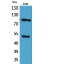 HSP90 / Heat Shock Protein 90 Antibody - Western blot of Acetyl-HSP 90 (K435) antibody